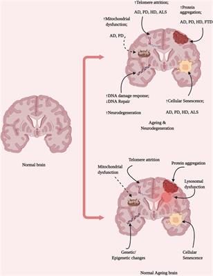 The Ageing Brain: Molecular and Cellular Basis of Neurodegeneration